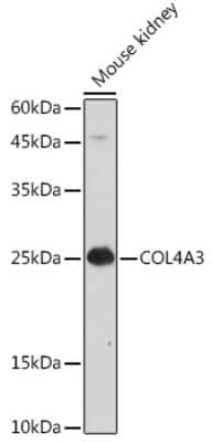 Western Blot: Tumstatin/COL4A3 AntibodyAzide and BSA Free [NBP3-02967]